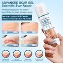 mitgary-advanced-scar-gel-silicone-scar--3.jpg