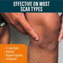 nuvadermis-extra-long-silicone-scar-shee-4.jpg