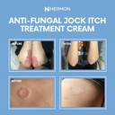hermon-jock-itch-cream-ringworm-treatmen-6.jpg