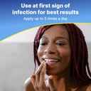 taro-cold-sore-fever-blister-treatment-d-5.jpg