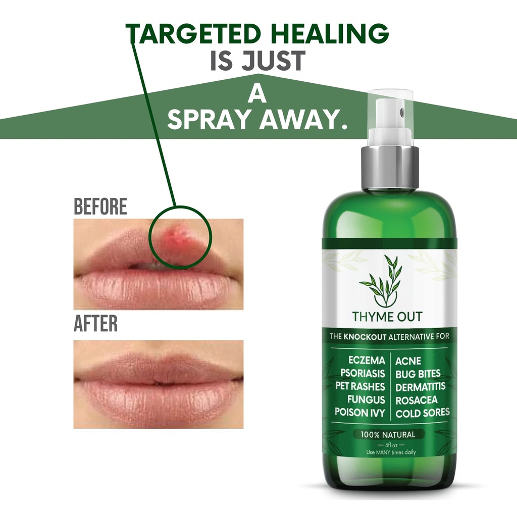 thyme-out-all-natural-eczema-treatment-p-5.jpg