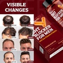 dht-blocker-for-men-hair-growth-suppleme-6.jpg