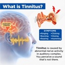 acupeace-tinnitus-relief-device-auricalm-5.jpg