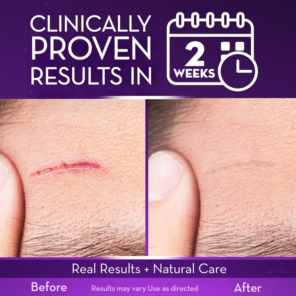 cicatricure-advanced-scar-gel-proven-res-71ZmMBgVOtL.jpg