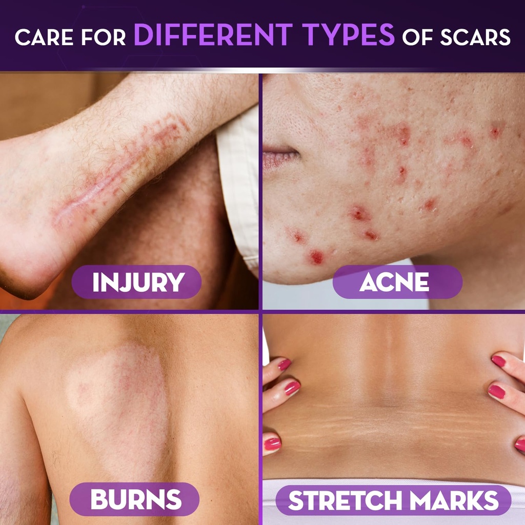cicatricure-advanced-scar-gel-proven-res-714EsYCLRAL.jpg