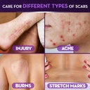 cicatricure-advanced-scar-gel-proven-res-714EsYCLRAL.jpg