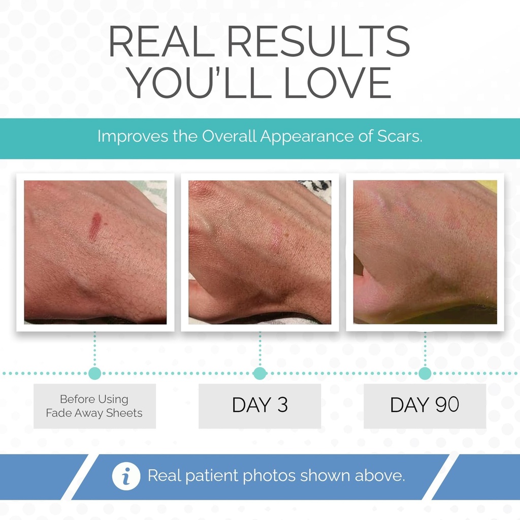 clinically-proven-silicone-scar-sheets-m-71ekBHO+NWL.jpg