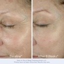 obagi-elastiderm-eye-cream-lightweight-s-3.jpg