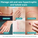dimora-hydrocolloid-wound-dressing-silic-6.jpg