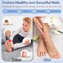 nail-fungus-laser-treatment-led-light-de-6.jpg