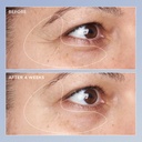 perricone-md-high-potency-triple-retinol-4.jpg