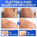 silicone-scar-sheets-surgical-tape-16x12-2.jpg