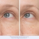 obagi-daily-hydro-drops-rejuvenating-eye-5.jpg