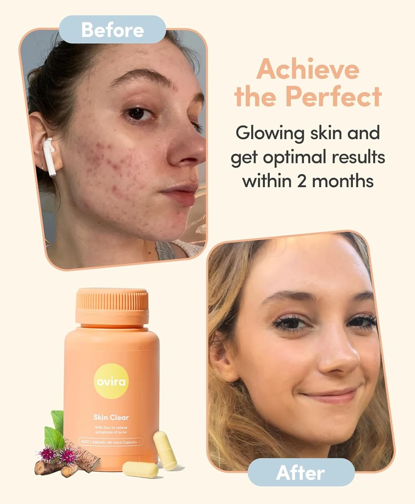 ovira-skin-clear-with-zincbright---60-ca-6.jpg