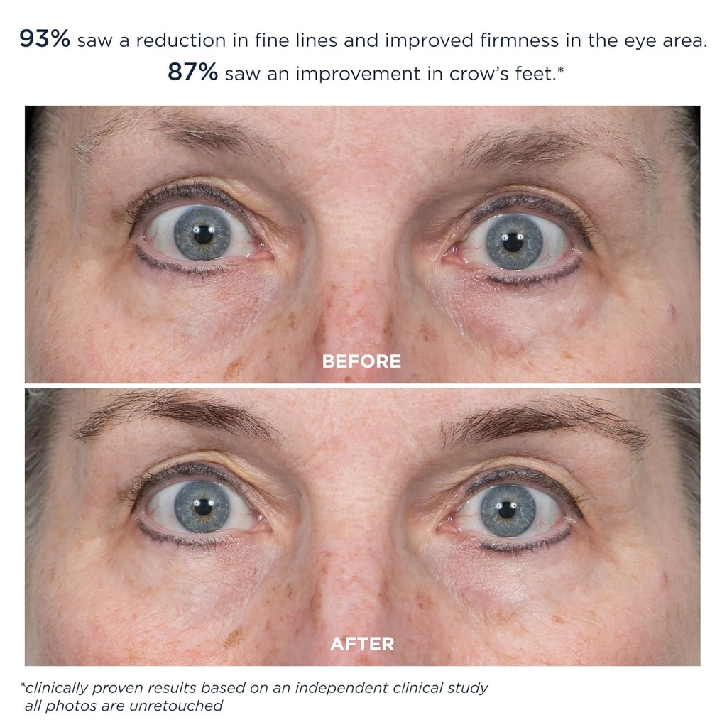 m-61-prosmooth-retinol-eye-serum-01-non--4.jpg