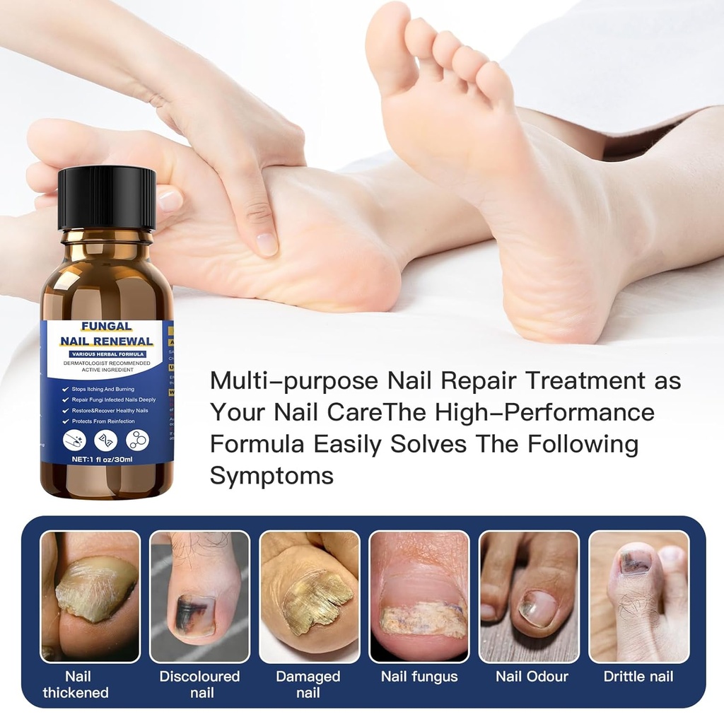 toenail-fungus-treatmentfoot-fungus-trea-4.jpg