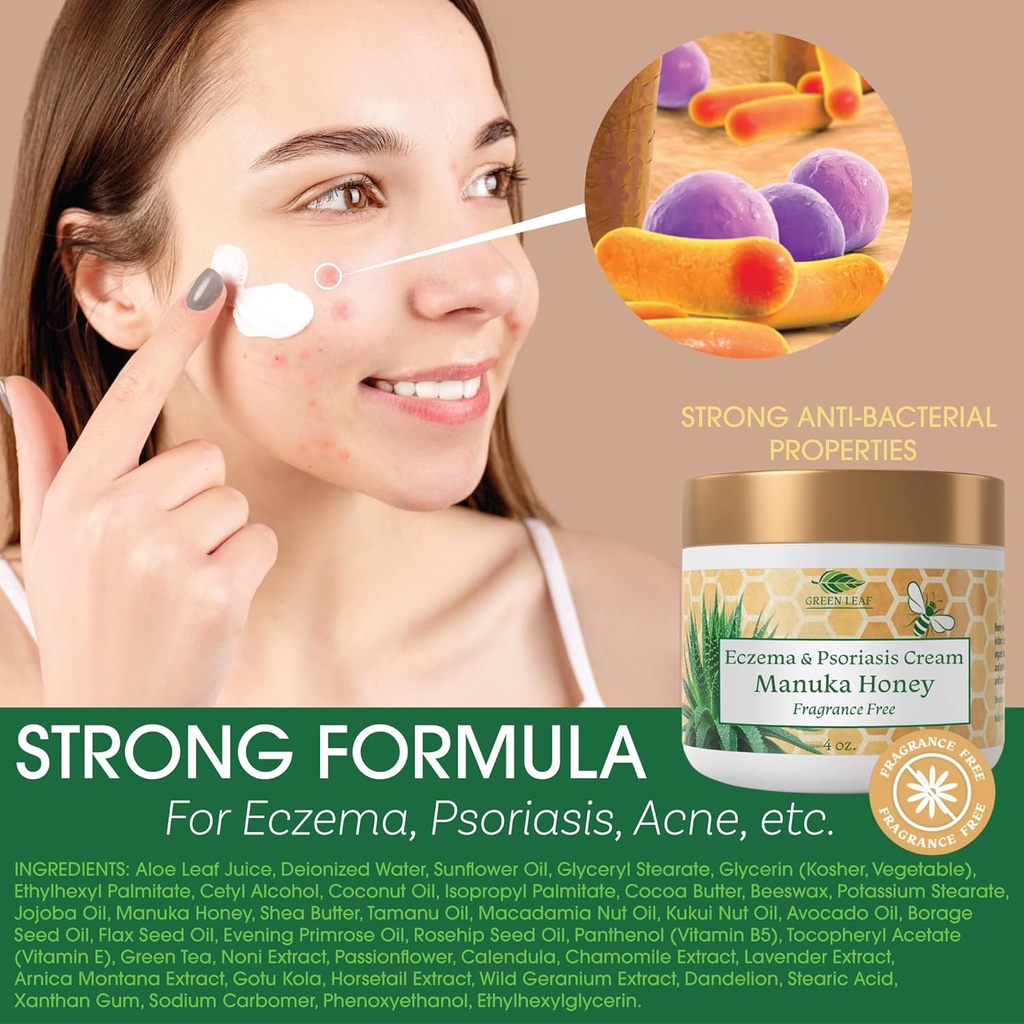 manuka-honey-eczema-cream-moisturizing-l-2.jpg