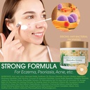 manuka-honey-eczema-cream-moisturizing-l-2.jpg