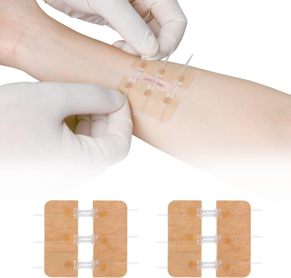 Stitches Kelebek Bandaids Hızlı Clot olmadan Çarpma Onarımı - Acil Yaralar Cihazı 2 Adet (PU)