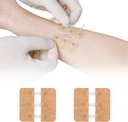 Stitches Kelebek Bandaids Hızlı Clot olmadan Çarpma Onarımı - Acil Yaralar Cihazı 2 Adet (PU)