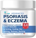 Bio-MD Psoriasis Eczema Cream, Yetişkinler için Eczema Kremi, Ekstra Güçlü Kontrol Reoccurrence, Relieve Symptom of Direnç, Seborrheic Dermatitis için Etkili, Folliculitis Tedavisi